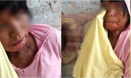 Una joven wichí que sufrió quemaduras al inhalar nafta. (Foto: captura de video El Tribuno). Una joven wichí que sufrió quemaduras al inhalar nafta. (Foto: captura de video El Tribuno).