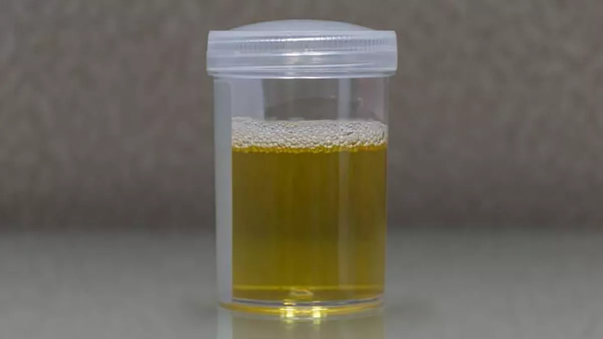 No se debe consumir orina de otra persona.