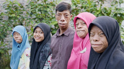 El misterioso caso de los Surya: la familia de Indonesia cuyos rostros se transforman con los años