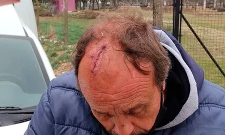 Tras el ataque, el hombre de 60 años sufrió un traumatismo de cráneo y una herida cortante en esa zona de unos 10 centímetros, por lo que tuvo que ser derivado al Hospital Municipal para su sutura. En tanto, el agresor que en una primera instancia fue trasladado en un patrullero a la Comisaría Séptima, ya fue liberado. Tras el ataque, el hombre de 60 años sufrió un traumatismo de cráneo y una herida cortante en esa zona de unos 10 centímetros, por lo que tuvo que ser derivado al Hospital Municipal para su sutura. En tanto, el agresor que en una primera instancia fue trasladado en un patrullero a la Comisaría Séptima, ya fue liberado.