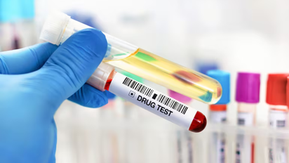 Diputados proponen que jueces, legisladores y ministros se realicen exámenes toxicológicos obligatorios