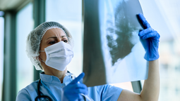 altText(Cáncer de pulmón: por qué la detección temprana es clave para reducir muertes)}