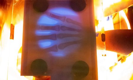 Un youtuber fabricó su propia máquina de rayos X luego de recibir una factura de hospital de casi 70.000 dólares. Un youtuber fabricó su propia máquina de rayos X luego de recibir una factura de hospital de casi 70.000 dólares.