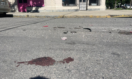 Sangre en el pavimento: el saldo del grave accidente que ocurrió este viernes al mediodía en el sur de la ciudad de Santa Fe. Sangre en el pavimento: el saldo del grave accidente que ocurrió este viernes al mediodía en el sur de la ciudad de Santa Fe.