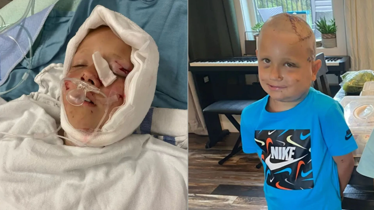 Cason Feuser, un nene de 8 años canadiense que se fue de campamento con sus amigos, fue atacado brutalmente por un puma que le mordió la cabeza y de milagro está vivo. 