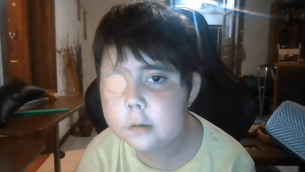 El niño chileno Tomás Blanch más conocido como Tomiii 11 y que llegó a convertirse en una estrella de YouTube, murió en agosto de 2021 luego de luchar contra un tumor cerebral.