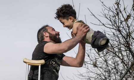 Italia, movilizada para ayudar a Mustafa: el nene sirio que no tiene ni brazos, ni piernas Italia, movilizada para ayudar a Mustafa: el nene sirio que no tiene ni brazos, ni piernas