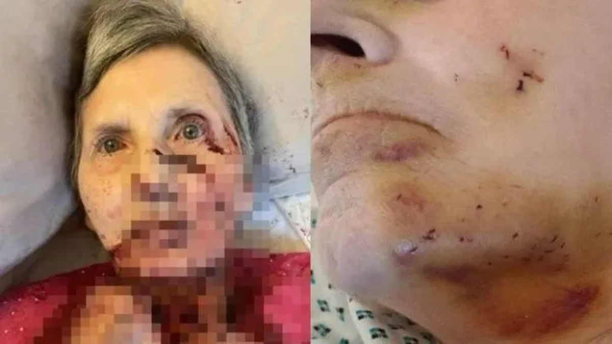 Diana Kirk (76) fue atacada por una rata mientras dormía por la noche.