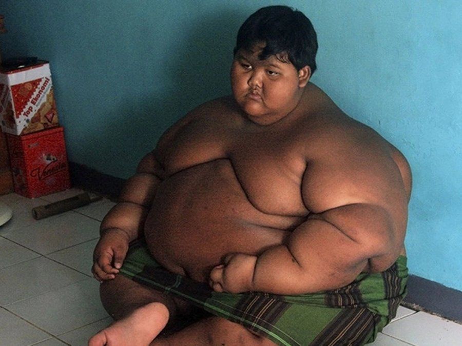 Cómo pudo recuperar su vida el niño más obeso del mundo