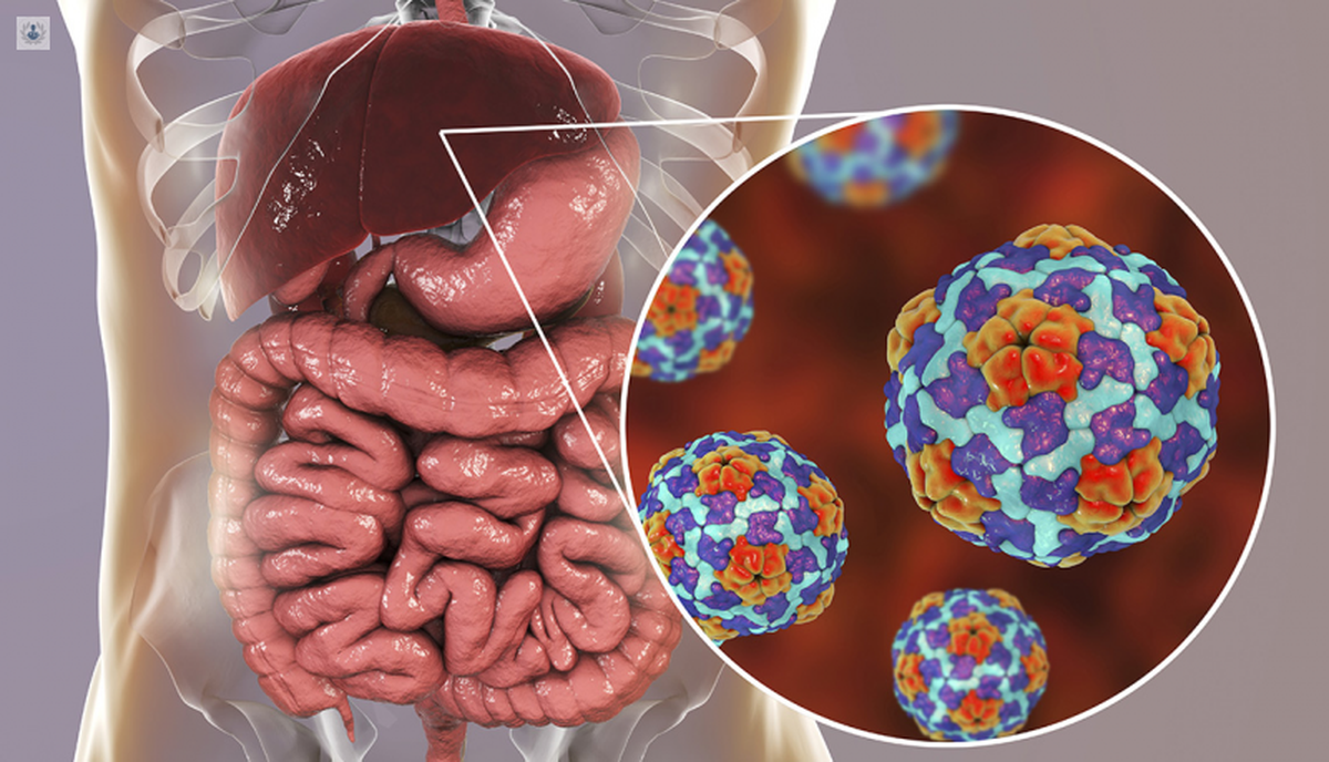 La hepatitis vírica es una enfermedad que afecta el hígado y puede ser causada por cinco virus diferentes. 