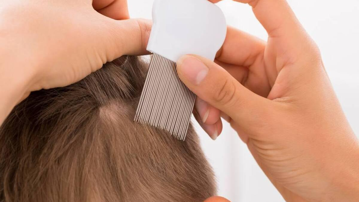 Pediculosis: remedios caseros para eliminar los piojos del hogar