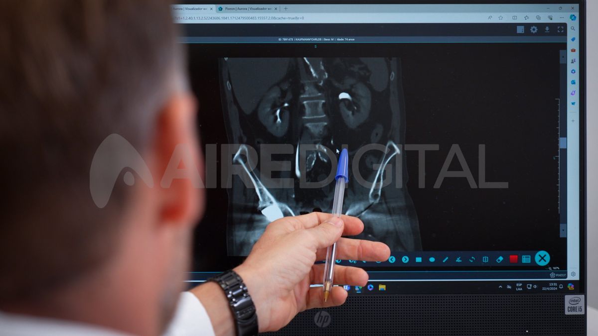 Hoy, con métodos simples de diagnóstico como una ecografía, o un examen digital rectal, es posible abordar la patología prostática y aplicar un tratamiento. Hoy, con métodos simples de diagnóstico como una ecografía, o un examen digital rectal, es posible abordar la patología prostática y aplicar un tratamiento.
