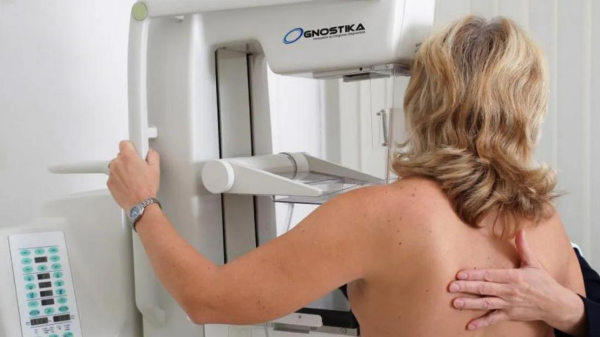 El 77% de los casos de cáncer de mama se registran en mujeres mayores de 50 años. El 77% de los casos de cáncer de mama se registran en mujeres mayores de 50 años.