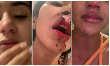 Daniela Cortés, denunció a su novio Sebastián Villa por violencia de género. Daniela Cortés, denunció a su novio Sebastián Villa por violencia de género.