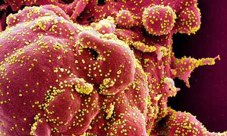hallaron en el covid-19 un fragmento de proteina especificamente humano hallaron en el covid-19 un fragmento de proteina especificamente humano