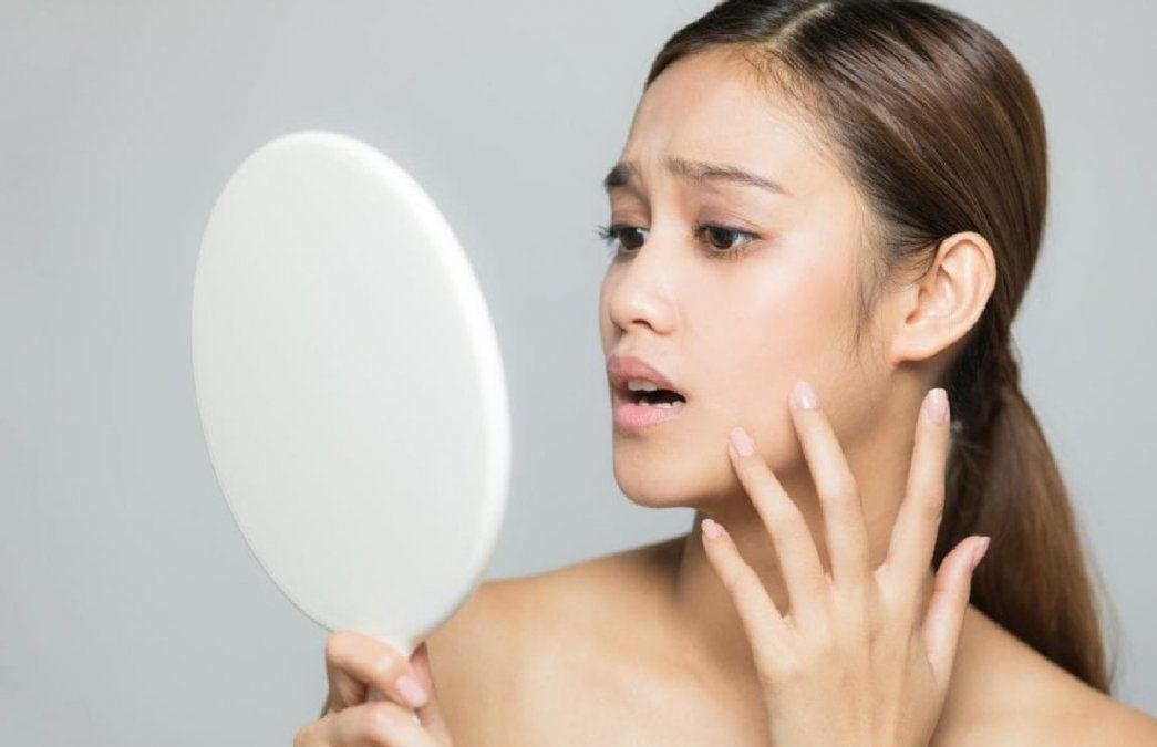 Las manchas en la piel son un problema estético