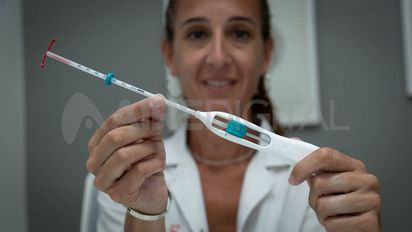 Métodos anticonceptivos y el derecho a decidir sobre el propio cuerpo