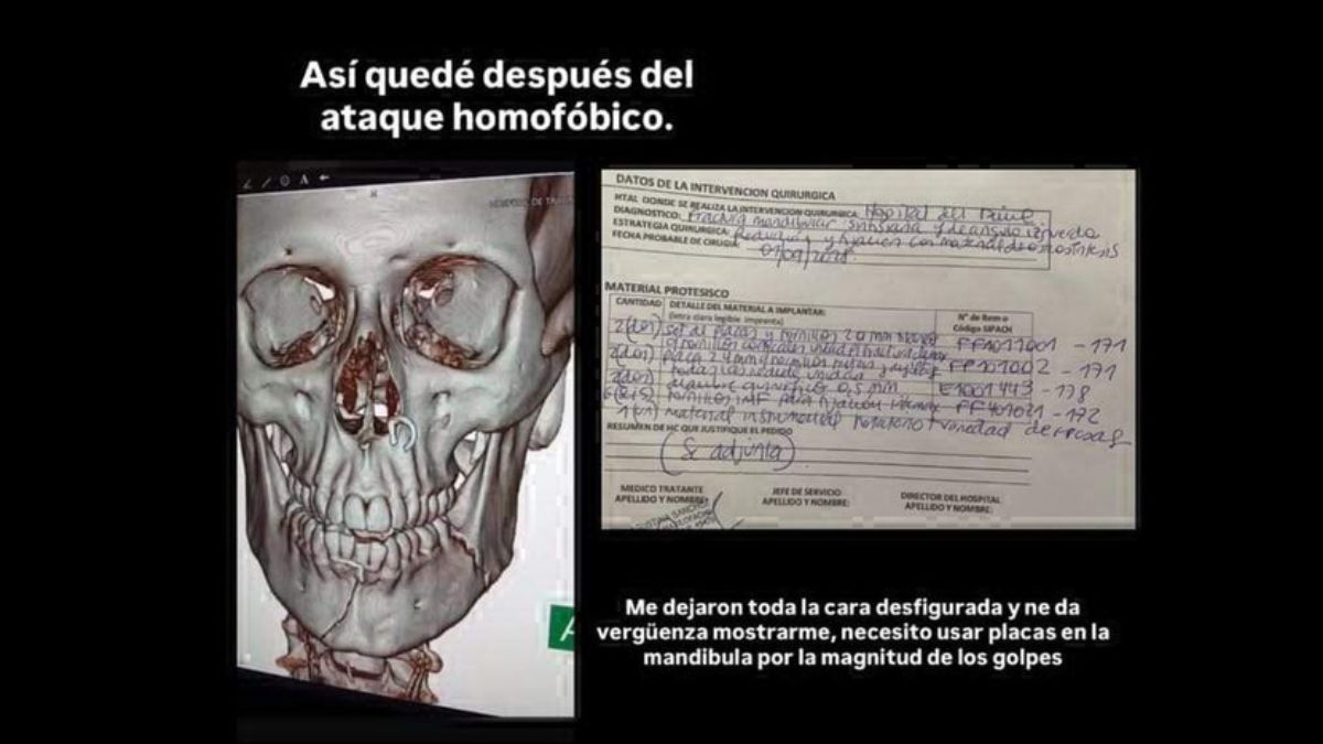 Juan Sabín utilizó sus redes sociales para hacer público el ataque que sufrió en Palermo. Juan Sabín utilizó sus redes sociales para hacer público el ataque que sufrió en Palermo.