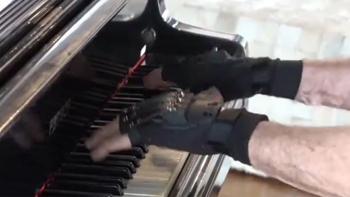 Video: los guantes biónicos que le cambiaron la vida a un pianista
