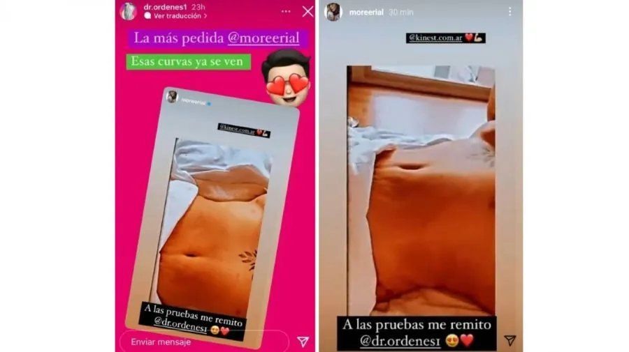 Así quedó More Rial tras someterse a cirugías estéticas. 