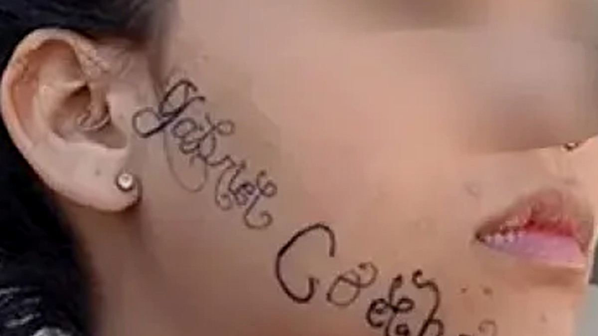 Su ex novio la secuestró y le tatuó su nombre en la cara para dejarla marcada