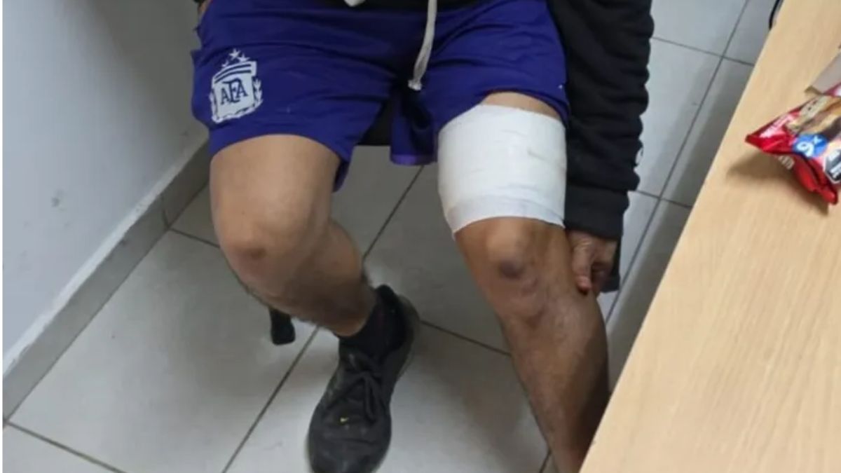 El joven terminó herido mientras se hacía un tatuaje.