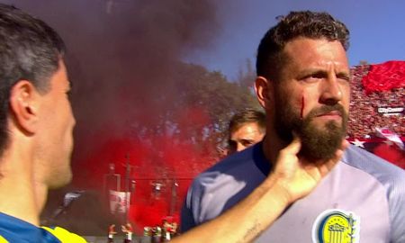 Jorge Broun fue alcanzado por una bengala, tuvo que ser asistido y el clásico rosarino tuvo que comenzar más tarde. Jorge Broun fue alcanzado por una bengala, tuvo que ser asistido y el clásico rosarino tuvo que comenzar más tarde.