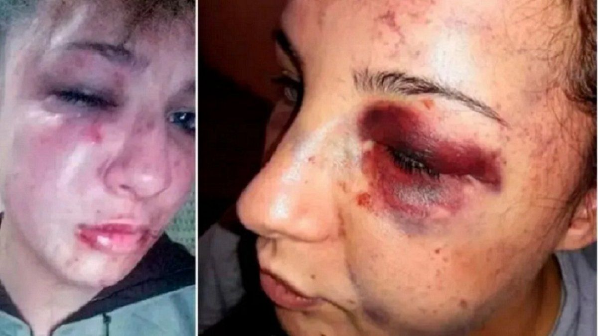 Un ex preso desfiguró a trompadas y patadas a su ex y le robó