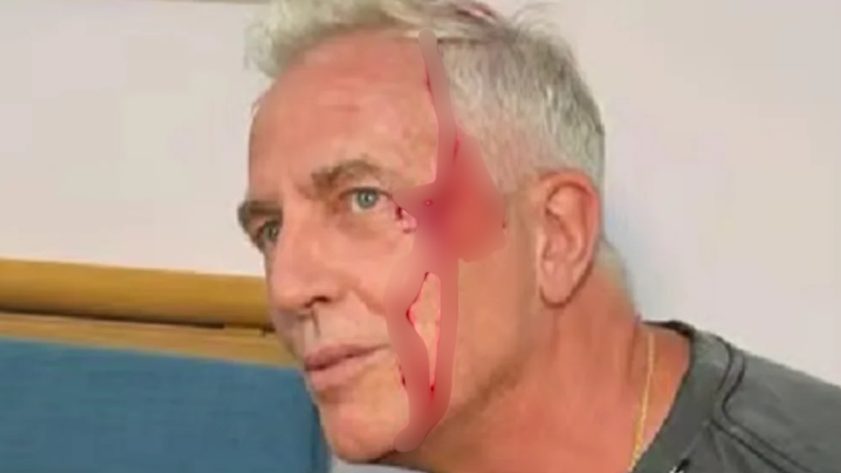 Se accidentó Marley durante un viaje en Tailandia.