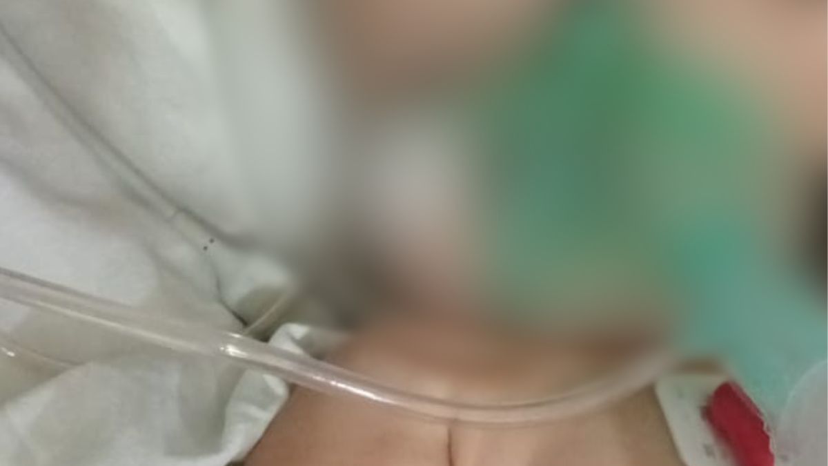 La bebé cayó en una pequeña pileta mientras mordía un flotador, perdiendo el conocimiento. La bebé cayó en una pequeña pileta mientras mordía un flotador, perdiendo el conocimiento.