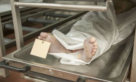 Las empresas que comercian con cadáveres deberían tener más regulación, dicen los expertos. Las empresas que comercian con cadáveres deberían tener más regulación, dicen los expertos.