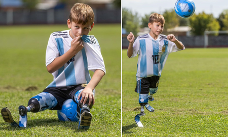 Ian Delbino, un niño de 8 años con agenesia, es apasionado del fútbol y sueña con conocer a Lionel Messi. Ian Delbino, un niño de 8 años con agenesia, es apasionado del fútbol y sueña con conocer a Lionel Messi.