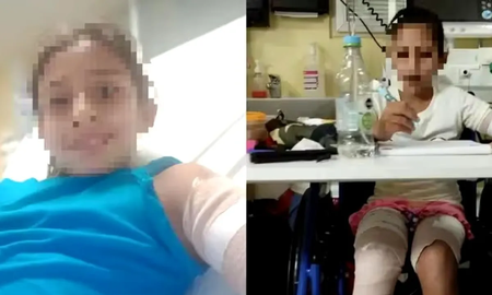 Lomas de Zamora: una mujer denunció que un nene de 10 años prendió fuego a su hija por celos Lomas de Zamora: una mujer denunció que un nene de 10 años prendió fuego a su hija por celos