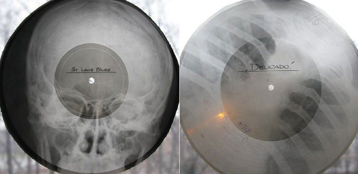 El ingenio de los rusos para reproducir la música prohibida por le régimen: utilizaban placas radiográficas descartadas de los hospitales