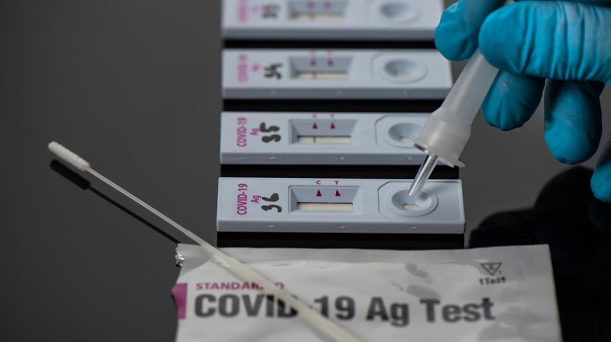 Autotest covid: d&oacute;nde se puede comprar.