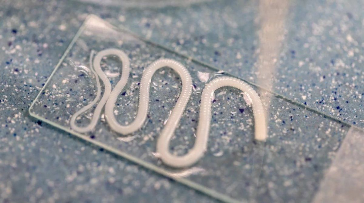 Tuvo un asqueroso insecto durante más de diez años en su cerebro