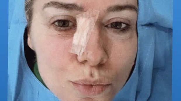 La periodista pidió tomar conciencia sobre la prevención y recomendó realizar controles dermatológicos dos veces por año.
