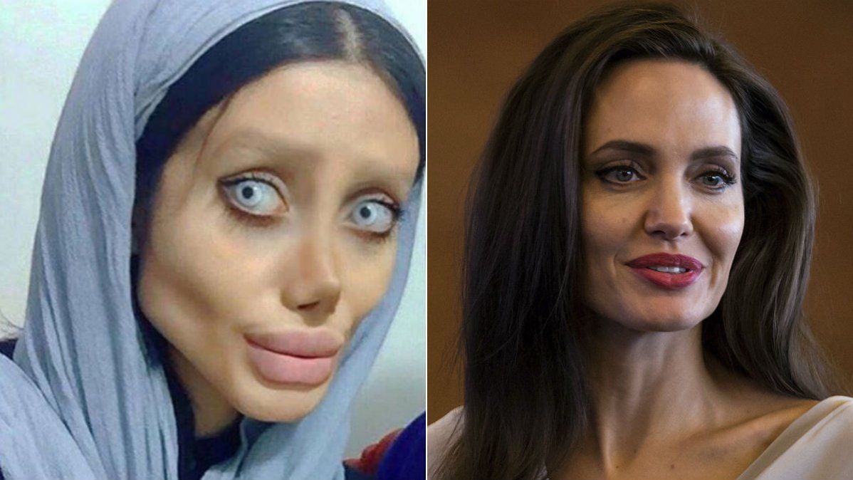 Se hizo famosa por su espeluznante parecido con la estadounidense Angelina Jolie