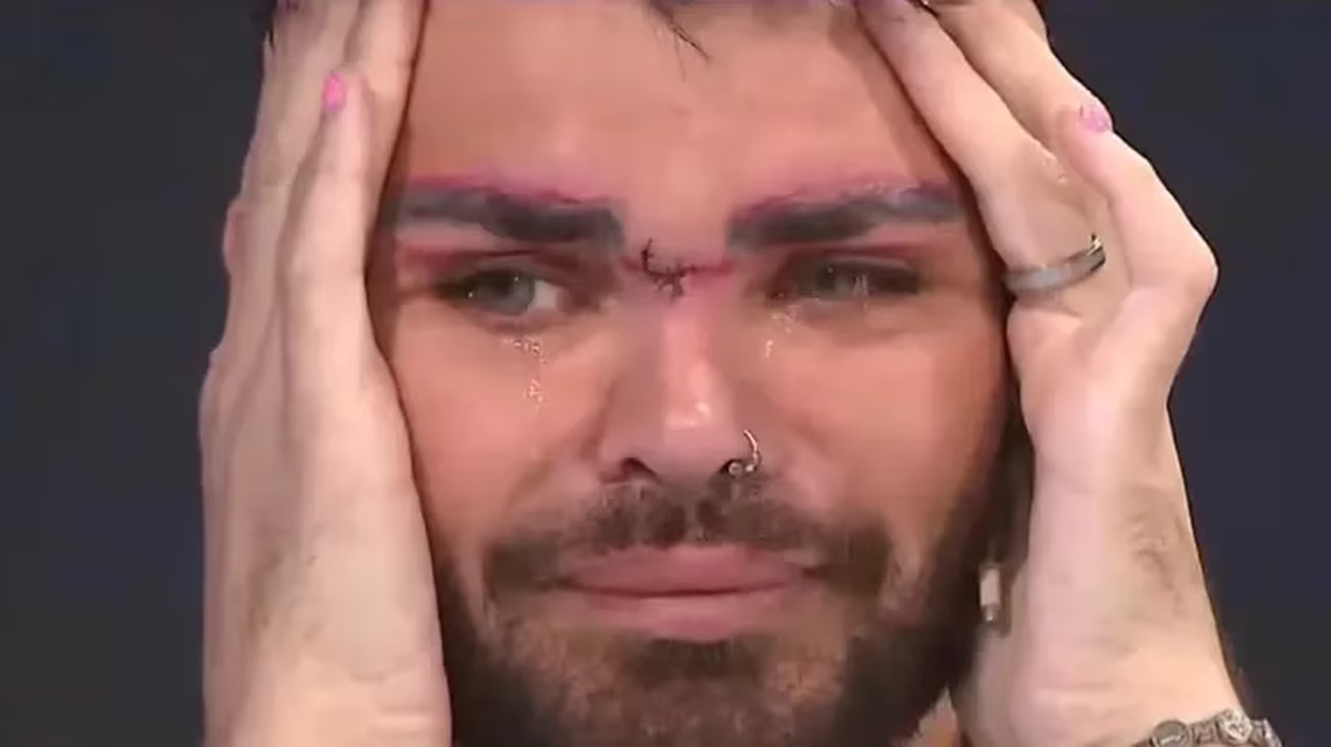 Fran Mariano fue paciente de Aníbal Lotocki, con quien se hizo varios retoques estéticos.