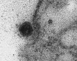 La imagen del microscopio muestra la formación de un punto negro que corresponde al patógeno del COVID-19. (EFE) La imagen del microscopio muestra la formación de un punto negro que corresponde al patógeno del COVID-19. (EFE)