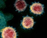 cientificos descubrieron que el nuevo coronavirus puede sobrevivir a mas de 60 grados