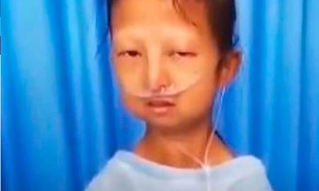 la historia de la joven que se alimento solo de arroz y chiles durante 5 anos para sostener a su hermano enfermo la historia de la joven que se alimento solo de arroz y chiles durante 5 anos para sostener a su hermano enfermo