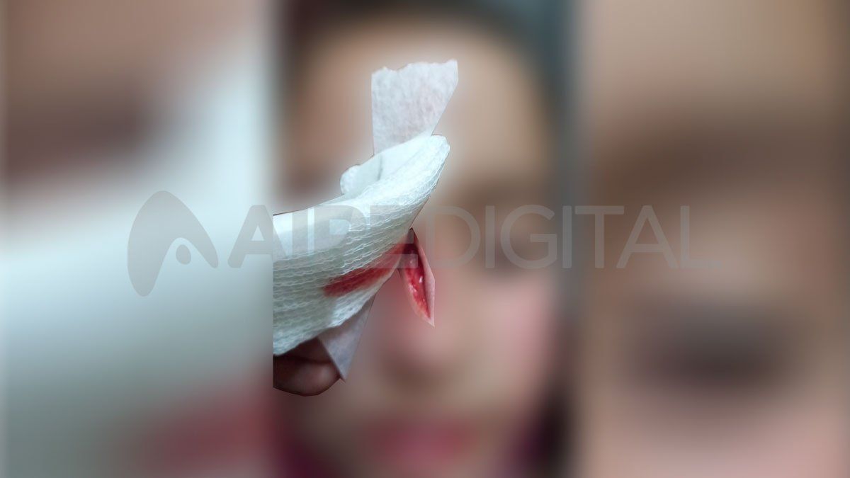 La niña atacada por el perro se encuentra en su casa tras haber sido atendida en el hospital de Niños.