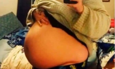 Transgénero se queja de dolor abdominal y en el hospital nadie sospechó que estaba “embarazado”