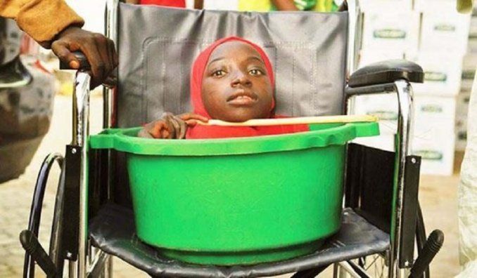 Rahma Haruna la joven sin cuerpo que vivía en un balde