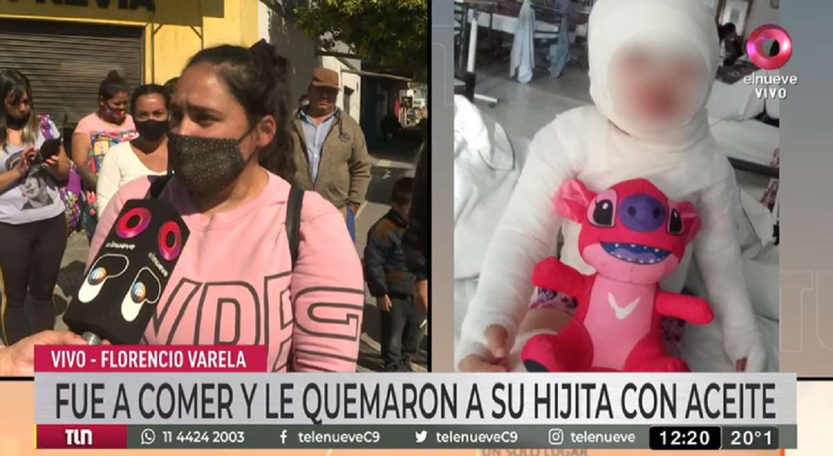 La niña de 3 años que sufrió quemaduras en el cuerpo, luego de que le volcaran aceite hirviendo en un restaurante de hamburguesas de Florencio Varela