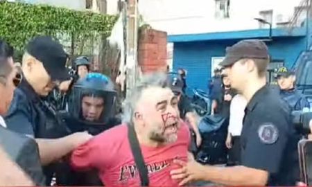 Facundo Tedechini sufrió heridas en su rostro durante el operativo policial en el Congreso. Facundo Tedechini sufrió heridas en su rostro durante el operativo policial en el Congreso.
