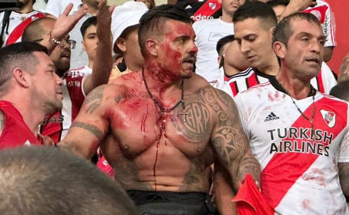 Ariel Calvici, el hincha que terminó ensangrentado.