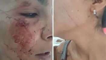 &nbsp;El ataque ocurrió en un descampado del límite entre los barrios Jorge Newbery y Carie. (Foto: 0223)