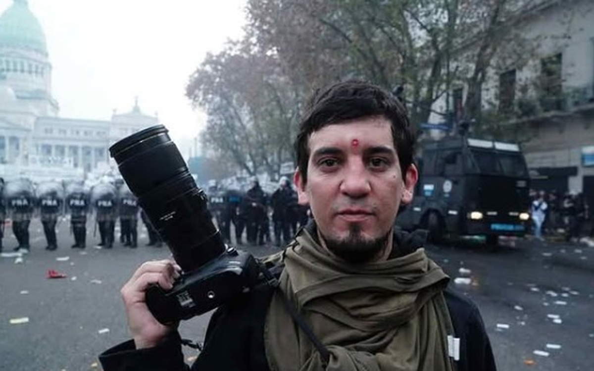 El reporto gráfico Mariano Dalaison, herido en la frente durante la cobertura del tratamiento de la Ley de Bases, uno de los casos enumerados por el Informe de Fatpren. El reporto gráfico Mariano Dalaison, herido en la frente durante la cobertura del tratamiento de la Ley de Bases, uno de los casos enumerados por el Informe de Fatpren.